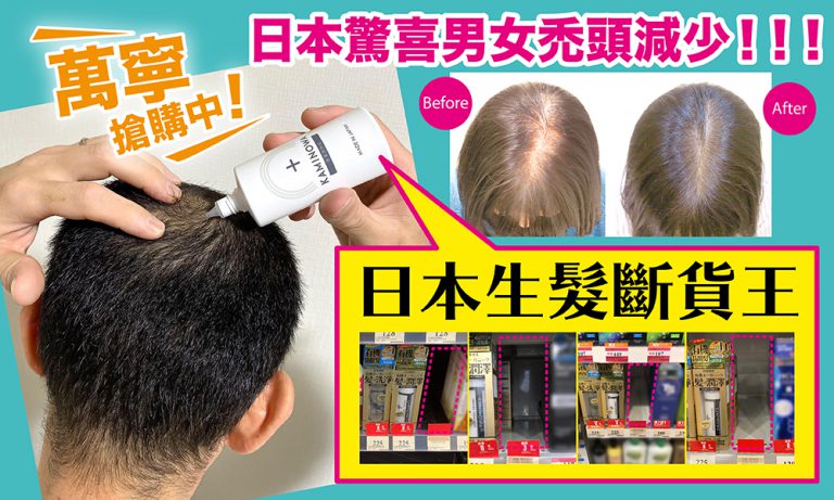【必看】日本驚喜消息:男女禿頭減少！日本’家用養髮術’太神了…萬寧斷貨王搶購中！